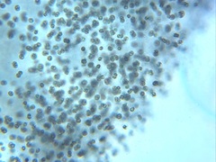 Microcystis