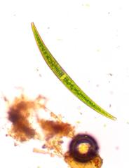 Closterium intermedium
