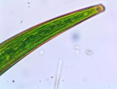 Closterium intermedium