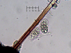 Podosphaera prunicola