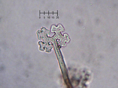 Podosphaera prunicola