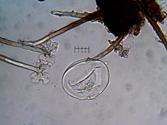 Podosphaera prunicola