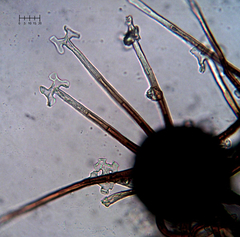 Podosphaera prunicola