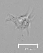Amoeba