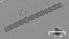 Anabaena