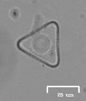 Desmidiaceae