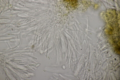 Pseudopeziza medicaginis