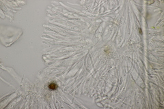 Pseudopeziza medicaginis