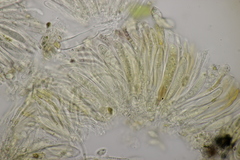 Pseudopeziza medicaginis