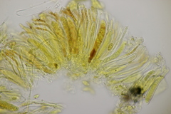 Pseudopeziza medicaginis