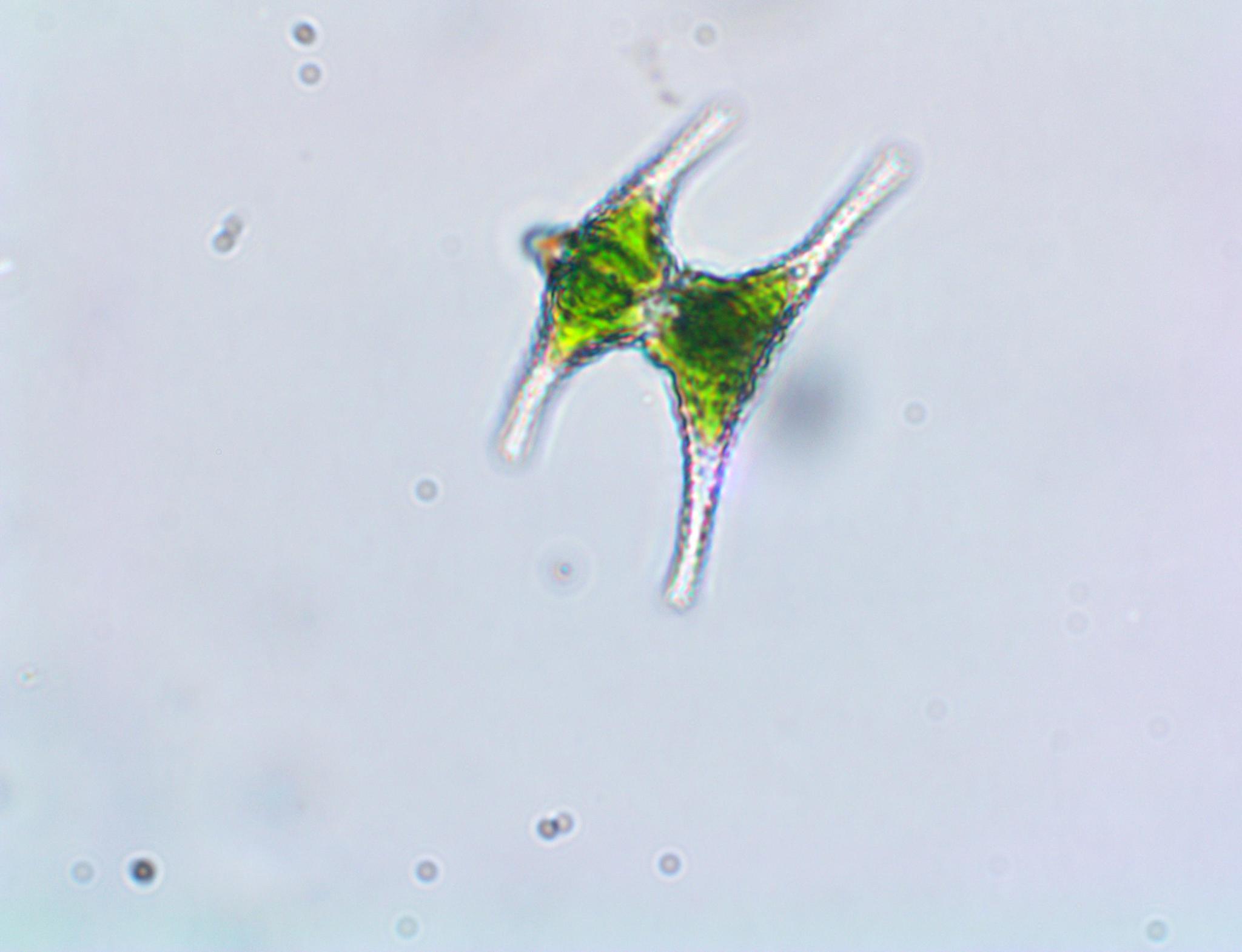 Staurastrum anatinum
