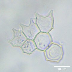 Pseudopediastrum boryanum