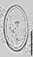 Cocconeis placentula