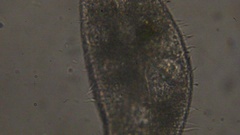 Oxytrichidae