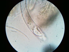 Pezicula carpinea