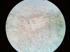 Pezicula carpinea