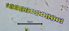Desmidiaceae