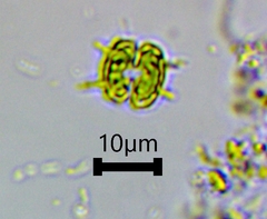 Sphaerozosma filiforme