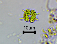 Sphaerozosma filiforme