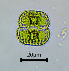 Cosmarium punctulatum