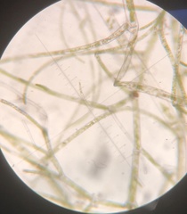 Cladophora liniformis