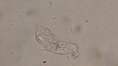 Trichamoeba