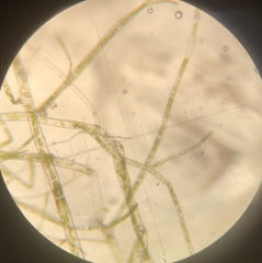 Cladophora liniformis