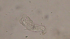 Trichamoeba
