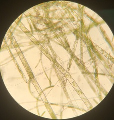 Cladophora liniformis