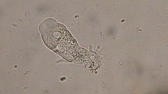 Trichamoeba