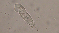 Trichamoeba