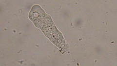 Trichamoeba