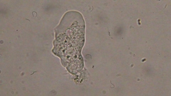 Trichamoeba