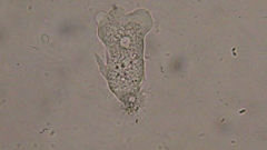 Trichamoeba