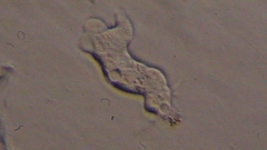 Trichamoeba