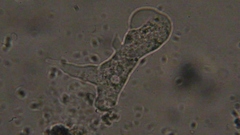 Trichamoeba