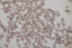 Microbotryum stellariae