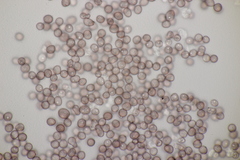 Microbotryum stellariae