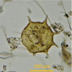 Centropyxis aculeata