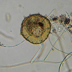 Centropyxis aculeata