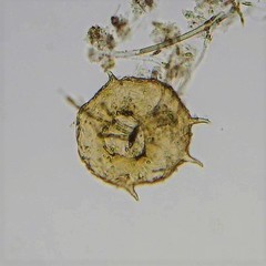 Centropyxis aculeata