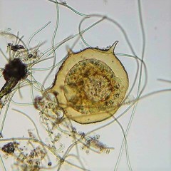 Centropyxis aculeata