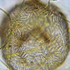 Centropyxis aculeata