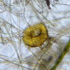 Centropyxis aculeata