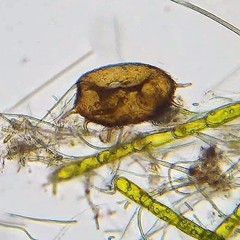 Centropyxis aculeata