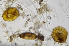 Centropyxis aculeata