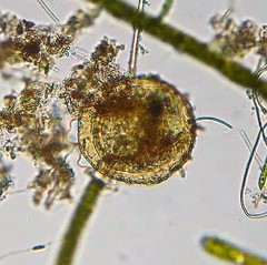 Centropyxis aculeata