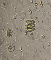 Scenedesmaceae