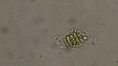 Scenedesmaceae