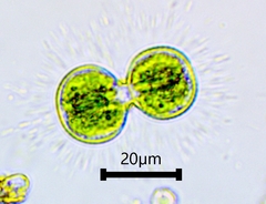 Cosmarium contractum